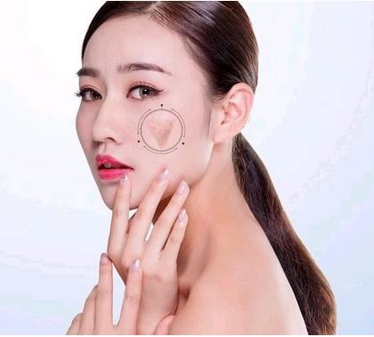 ?？诩t妝尚整形光子嫩膚