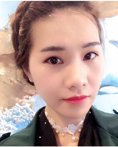 營口臻美醫(yī)療整形醫(yī)生閆迎軍做雙眼皮效果怎么樣？附雙眼皮案例對比圖