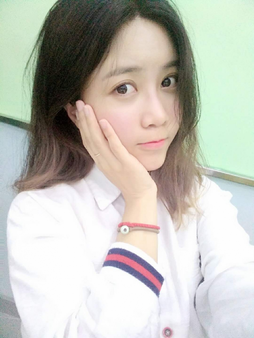 重慶美圣美邦整形醫(yī)院劉力維醫(yī)生做自體脂肪全臉填充案例效果對(duì)比圖