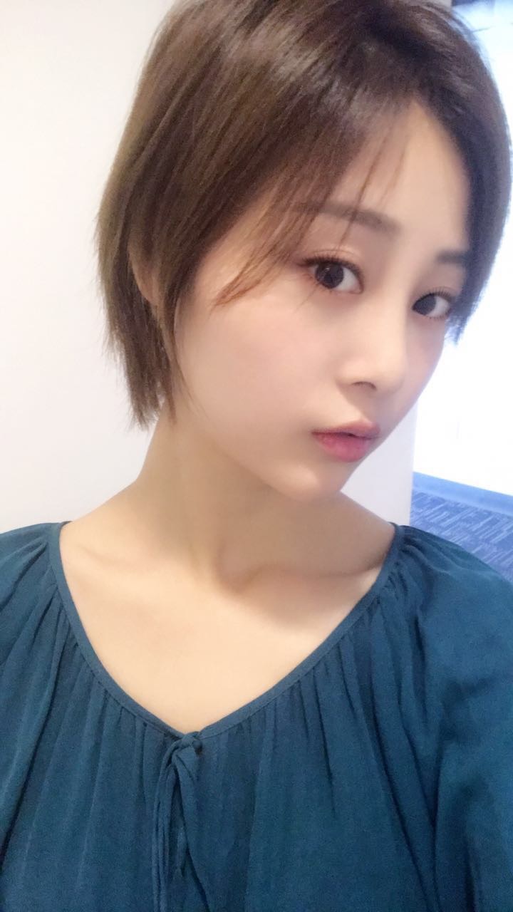 天津歐華威莎整形醫(yī)生姚玲做面部埋線提升效果怎么樣？附埋線提升案例