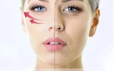 河北工程大學(xué)附屬醫(yī)院整形美容科彩光嫩膚