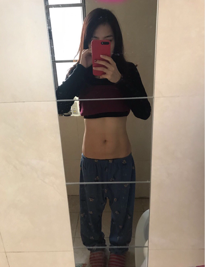 沈陽(yáng)天使醫(yī)療整形醫(yī)生黃展翼做水動(dòng)力腰腹吸脂技術(shù)怎么樣？附水動(dòng)力腰腹吸脂案例