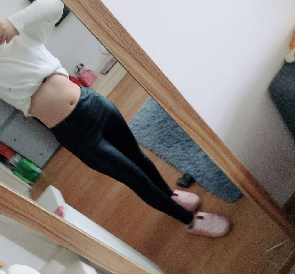 肇慶華美整形醫(yī)院陳巍醫(yī)生做腰腹吸脂效果怎么樣？附腰腹吸脂案例