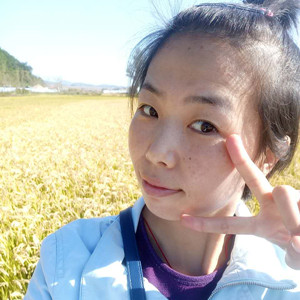 珠海蒂伊醫(yī)療整形醫(yī)生廖俊凱做激光祛斑效果怎么樣？附激光祛斑案例效果圖