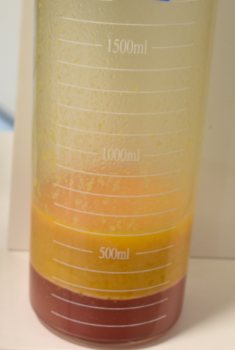 珠海海大整形美容外科黃發(fā)醫(yī)生做面部吸脂怎么樣？附面部吸脂案例