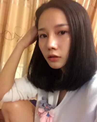 西安陽光整形醫(yī)院邵萍醫(yī)生做鼻綜合整形怎么樣？附鼻綜合整形案例