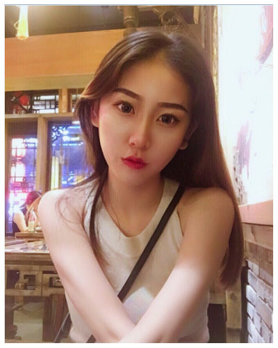 珠海海大整形美容外科黃發(fā)醫(yī)生做面部吸脂怎么樣？附面部吸脂案例