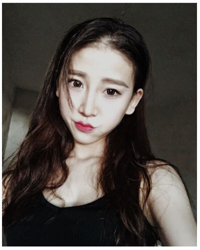 珠海海大整形美容外科黃發(fā)醫(yī)生做面部吸脂怎么樣？附面部吸脂案例