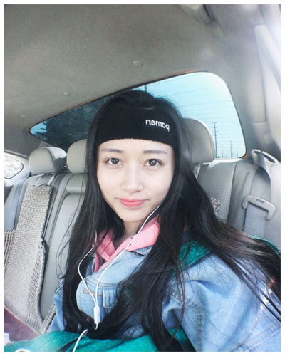 義烏傅氏口腔醫(yī)生朱雨晴做牙齒隱形矯正效果怎么樣？附牙齒隱形矯正案例