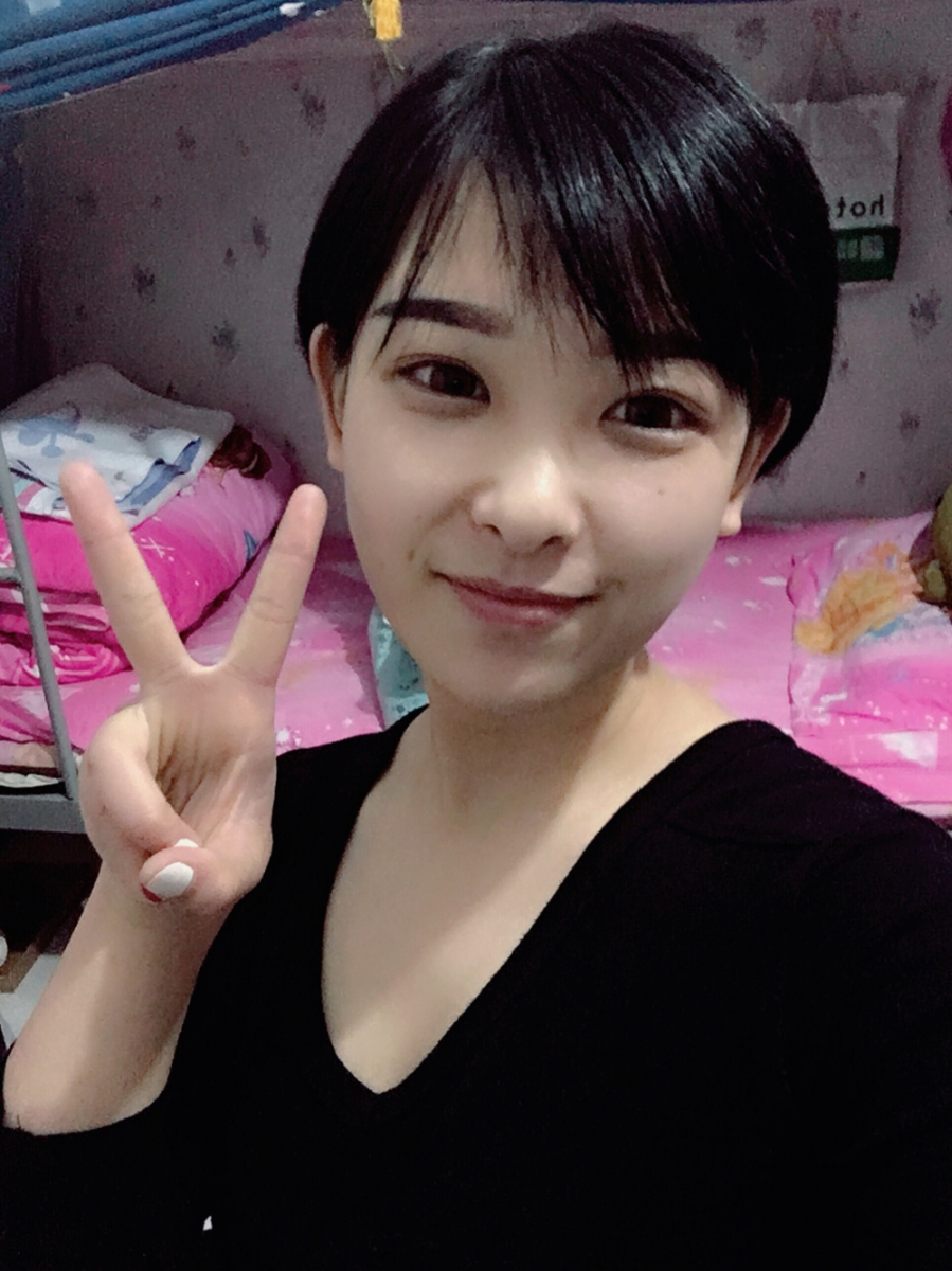 武漢肽慕醫(yī)美整形醫(yī)院楊婉菱醫(yī)生做面部吸脂效果怎么樣？附面部吸脂案例