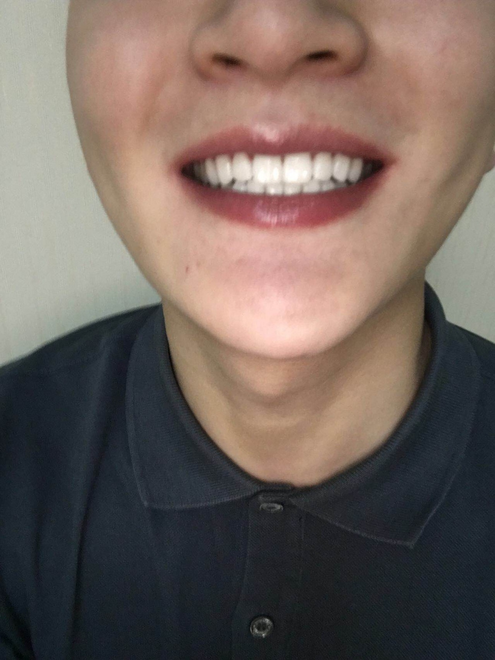 1518415490392757.jpg 1518415490392757.jpg