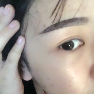 大同清木整形醫(yī)院張樹(shù)霞醫(yī)生做半永久紋眉效果如何？附半永久紋眉效果圖