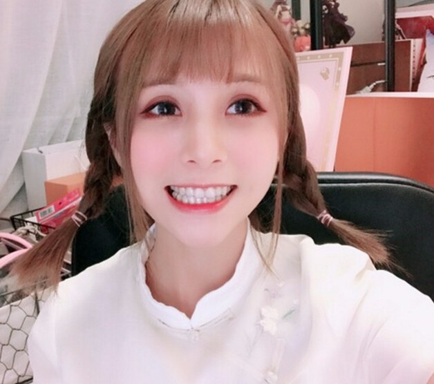 廣州德倫口腔醫(yī)生程武做隱形托槽矯正怎么樣？附隱形托槽矯正案例效果對比圖