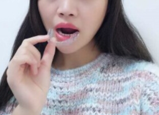 廈門拜博口腔醫(yī)院醫(yī)生張忠做牙齒隱形矯正怎么樣？附案例效果對比圖