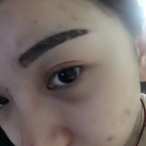 大同清木整形醫(yī)院張樹(shù)霞醫(yī)生做半永久紋眉效果如何？附半永久紋眉效果圖