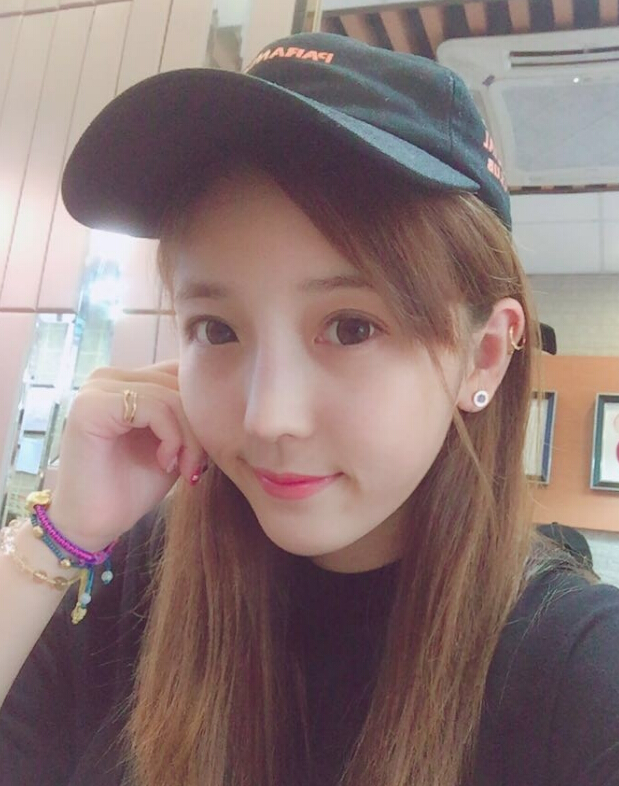 鄭州致美士整形醫(yī)院醫(yī)生閆江濤做鼻綜合+自體脂肪填充+吸脂案例效果對(duì)比圖