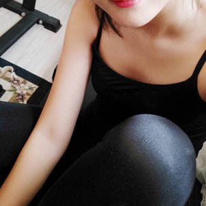 岳陽愛思特醫(yī)療美容醫(yī)院醫(yī)生王福生做手臂吸脂怎么樣？附案例效果圖