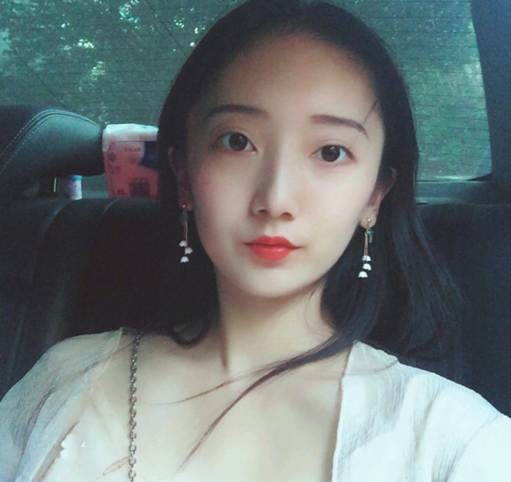 深圳鵬愛(ài)醫(yī)療美容醫(yī)院醫(yī)生文炯軫做埋線隆鼻怎么樣？附案例