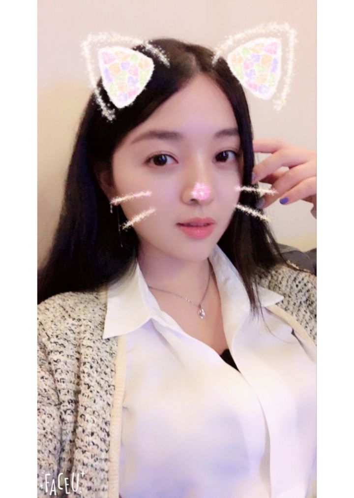 北京京韓整形醫(yī)生王義山做埋線雙眼皮怎么樣？附案例效果對(duì)比圖