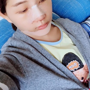 北京京民醫(yī)院整形外科醫(yī)生李鴻儒做硅膠隆鼻怎么樣？附案例效果圖