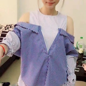 佛山東方女子醫(yī)院整形美容中心姜政輝做自體脂肪隆胸案例效果對比圖