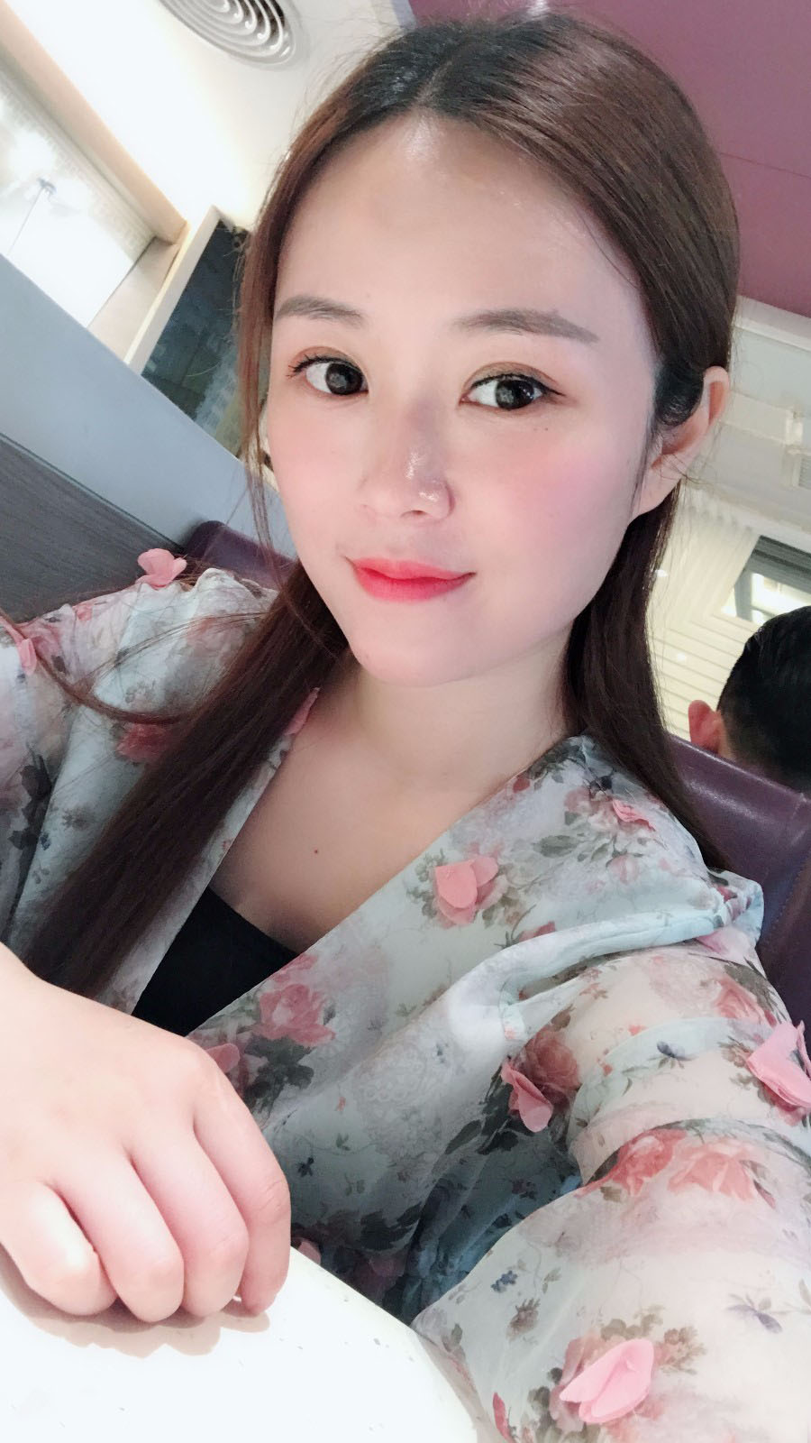 廣東韓妃醫(yī)療美容醫(yī)院做切開(kāi)雙眼怎么樣？附案例效果圖