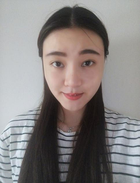 1528339588871451.jpg 深圳陽光整形美容醫(yī)院醫(yī)生張平做膨體隆鼻+雙眼皮+注射瘦臉案例效果對比圖