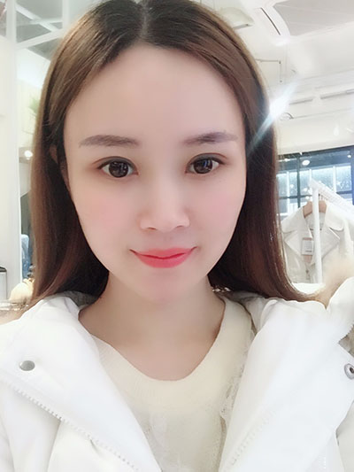 廣東韓妃醫(yī)療美容醫(yī)院做切開(kāi)雙眼怎么樣？附案例效果圖