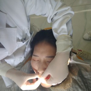 洛陽友好口腔醫(yī)院醫(yī)生李新然做牙貼面怎么樣？附案例效果圖