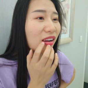 洛陽友好口腔醫(yī)院醫(yī)生李新然做牙貼面怎么樣？附案例效果圖
