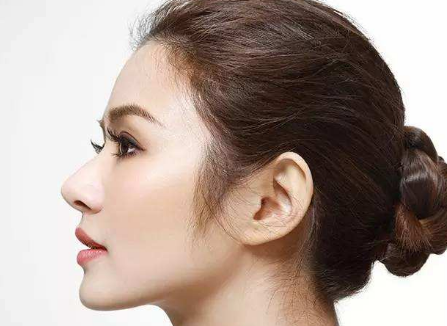 永州星雅整形鼻小柱延長(zhǎng)