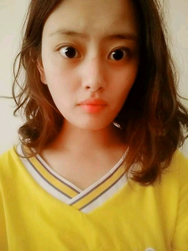 廣州愛來(lái)整形醫(yī)院醫(yī)生肖大衛(wèi)做激光點(diǎn)痣怎么樣？附案例效果對(duì)比圖