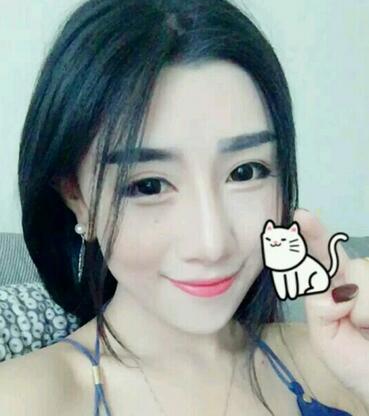 貴陽泰康樂醫(yī)院整形美容科醫(yī)生陳璐做自體脂肪全臉填充效果怎么樣？