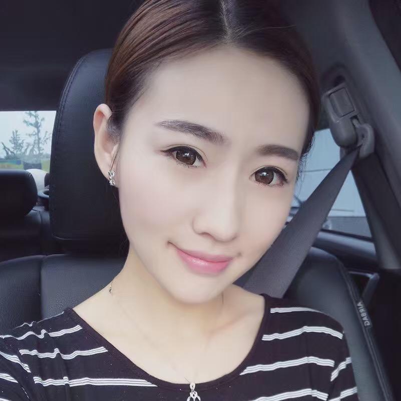 貴陽美和諧醫(yī)療整形醫(yī)生孫澤芳做切開雙眼皮效果怎么樣？附案例效果對比圖