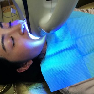 上?？仆呖谇会t(yī)院醫(yī)生鄧建儒做牙齒冷光美白怎么樣？附案例效果對(duì)比圖