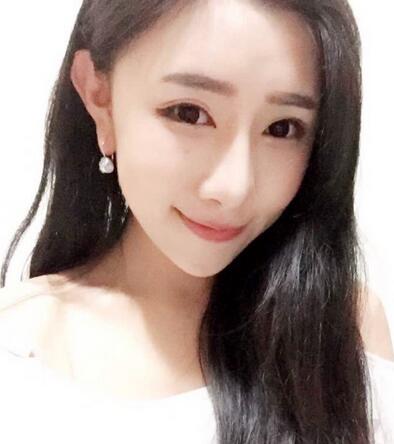 貴陽泰康樂醫(yī)院整形美容科醫(yī)生陳璐做自體脂肪全臉填充效果怎么樣？