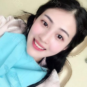 上海科瓦口腔醫(yī)院醫(yī)生鄧建儒做牙齒冷光美白怎么樣？附案例效果對(duì)比圖