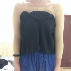 長沙柒和醫(yī)療整形醫(yī)生鐘滔做手臂吸脂怎么樣？附案例效果對(duì)比圖