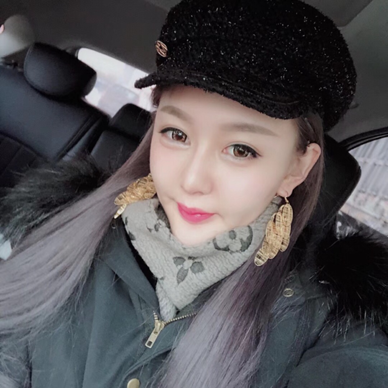 杭州格萊美整形美容醫(yī)院醫(yī)生張霞飛做自體脂肪全臉填充效果怎么樣？