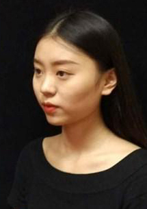 長沙星雅醫(yī)療美容醫(yī)院醫(yī)生陳煥武做埋線提升怎么樣？