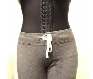 廣州尚美善造美容醫(yī)院醫(yī)生邵方做水動力吸脂怎么樣？附案例效果圖