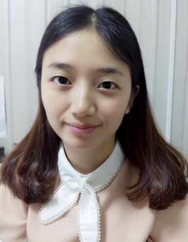 長治松禾醫(yī)療美容診所醫(yī)生馬俊峰做韓式微創(chuàng)定點雙眼皮效果怎么樣？附案例