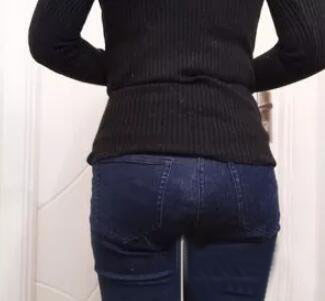 廣州尚美善造美容醫(yī)院醫(yī)生邵方做水動力吸脂怎么樣？附案例效果圖