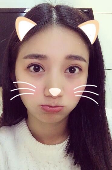 長治松禾醫(yī)療美容診所醫(yī)生馬俊峰做韓式微創(chuàng)定點雙眼皮效果怎么樣？附案例