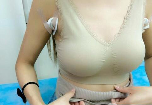 海南伊佳醫(yī)療美容醫(yī)院醫(yī)生涂陽(yáng)君做假體隆胸怎么樣？附案例效果對(duì)比圖