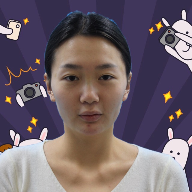 杭州格萊美整形美容醫(yī)院醫(yī)生張霞飛做自體脂肪全臉填充效果怎么樣？