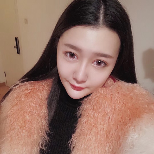 杭州格萊美整形美容醫(yī)院醫(yī)生張霞飛做自體脂肪全臉填充效果怎么樣？