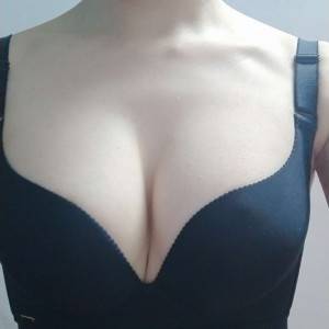 長(zhǎng)沙亞韓醫(yī)學(xué)美容醫(yī)院醫(yī)生鄭京湘做假體隆胸怎么樣？附醫(yī)生案例效果對(duì)比圖