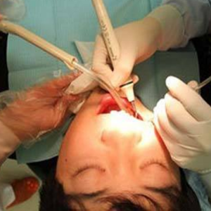 淄博口腔醫(yī)院醫(yī)生牟象鑫做超聲波洗牙怎么樣？附案例效果對(duì)比圖