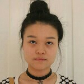 鄭州管城中醫(yī)院整形美容中心醫(yī)生張秀英做注射瘦臉怎么樣？附除皺瘦臉案例效果圖